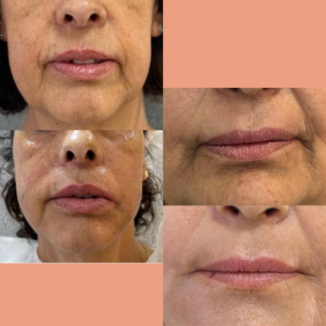 PÓS IMEDIATO DO NUTRICELL-min